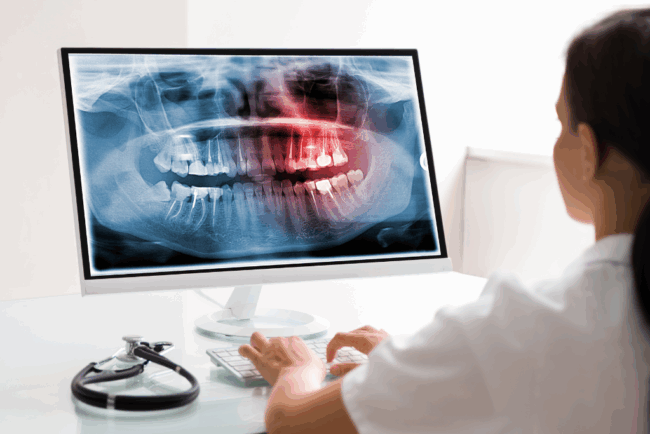 software-gestion-clinica-dental cirugía guiada en Ciudad Real