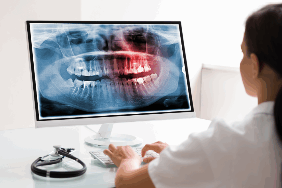 software-gestion-clinica-dental cirugía guiada en Ciudad Real