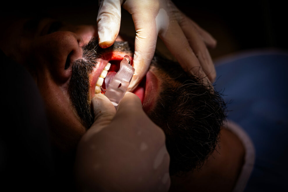 Sin título-02 Implantes de una sola pieza en casos con poco hueso