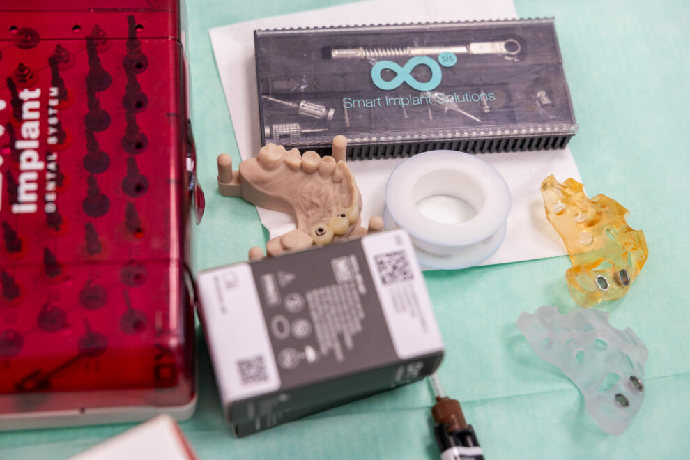 implantes dentales implantes dentales