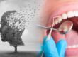 periodontitis y alzheimer