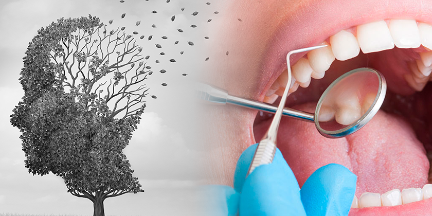 periodontitis y alzheimer