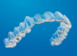 invisalign