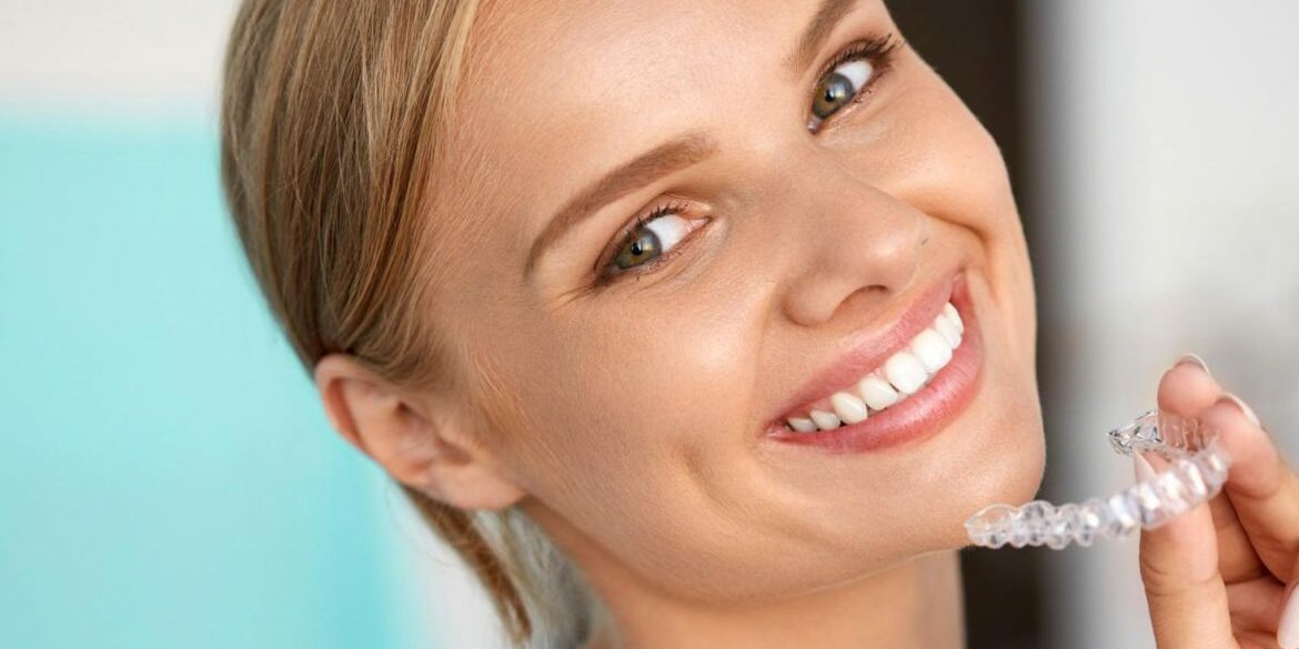 Invisalign en adultos Invisalign en adultos