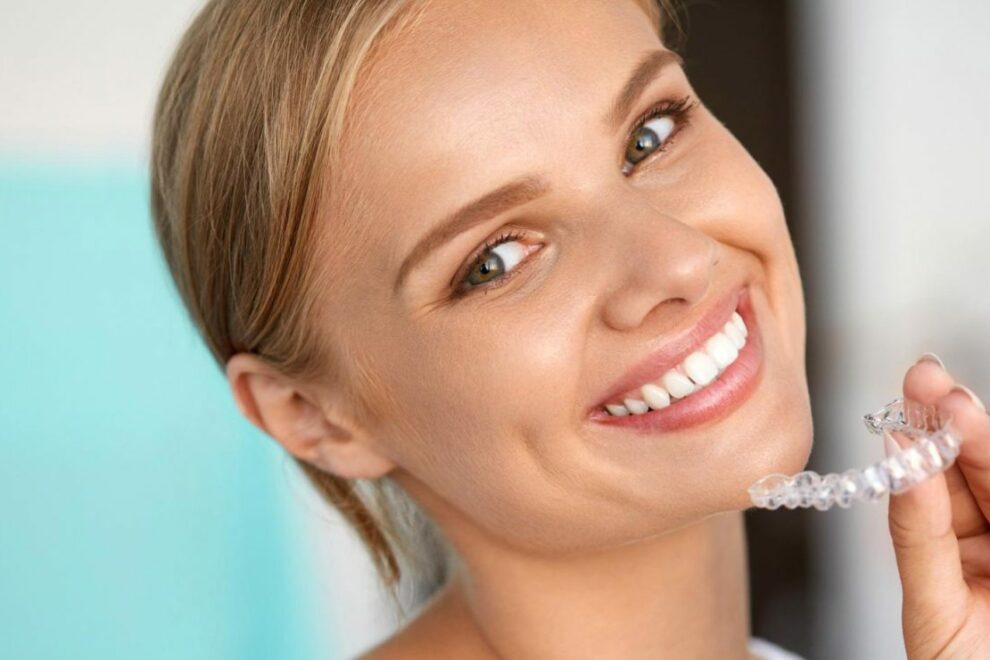 Invisalign en adultos Invisalign en adultos