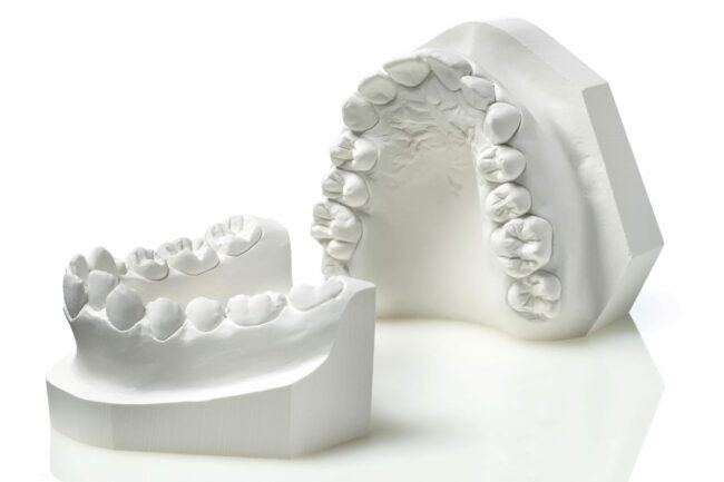 modelos de estudio en odontología